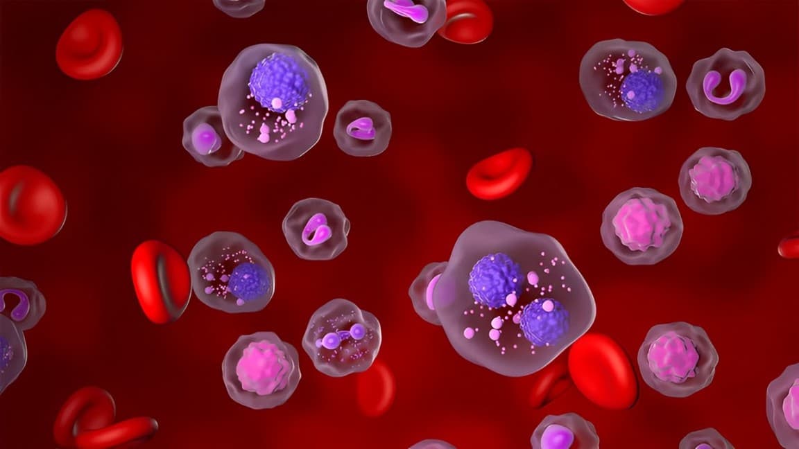 CARTITUDE-4 Data to Redefine Treatment of Multiple Myeloma: Legend Biotech's Key Reveal on Minimal Residual Disease