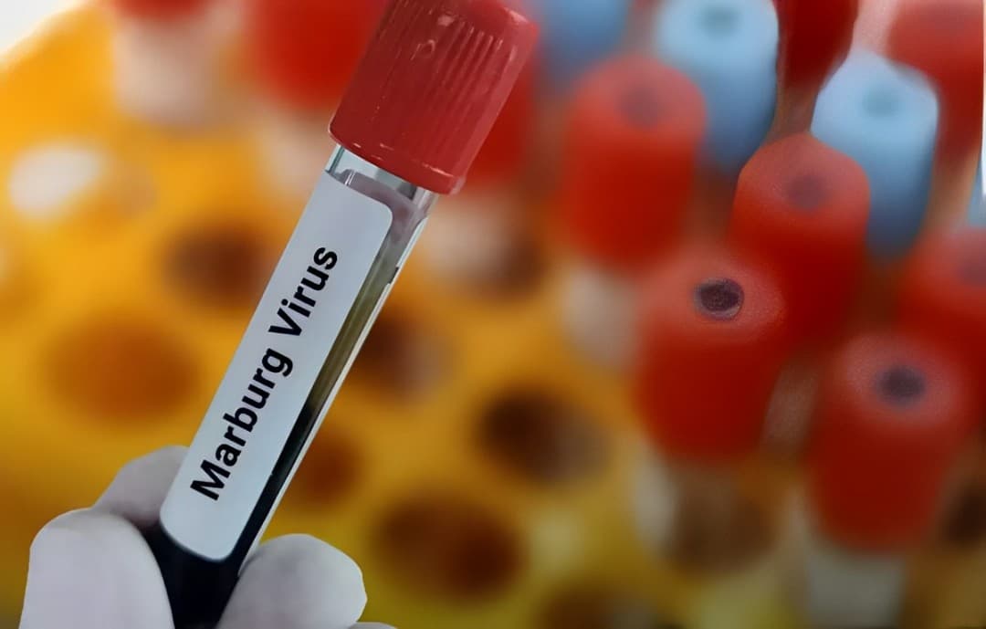 Rwanda Launches Marburg Vaccine Trial