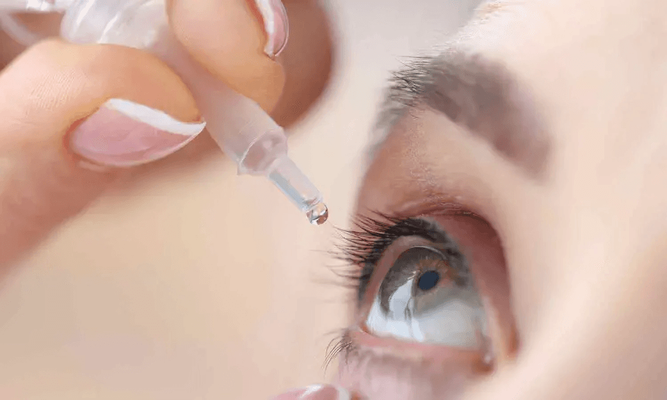 Pioneering Eye Drop Therapy for Dry Age-Related Macular Degeneration (AMD) Revolutionizing Treatment for a Leading Cause of Vision Loss