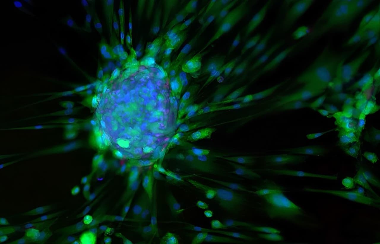 FibroBiologics Partners With Charles River To Revolutionize Fibroblast Cell Therapy For Chronic Diseases