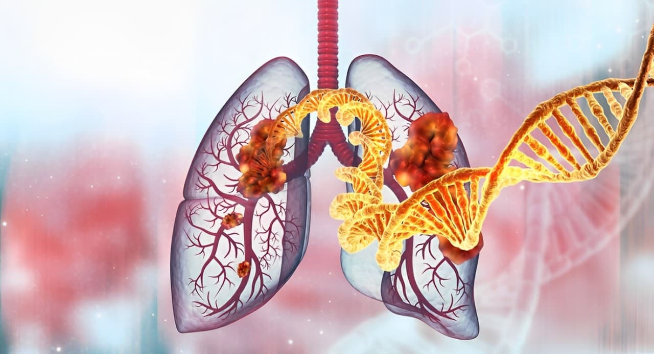 AstraZeneca and Daiichi Sankyo Refocus On New BLA Filed for Lung Cancer Drug Targeting EGFR-Mutated NSCLC