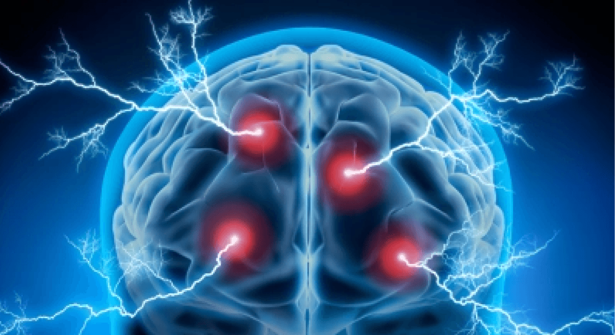 Alterity Therapeutics Receives U.S. FDA Fast Track Designation For ATH434 To Treat Multiple System Atrophy