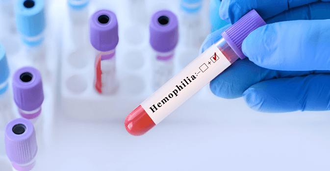 HYMPAVZI™ Wins EU Approval For Treating Hemophilia A And B