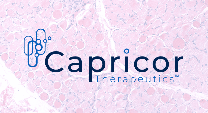 Capricor Announces Big Steps Forward In Duchenne Muscular Dystrophy Program With Key Regulatory Updates