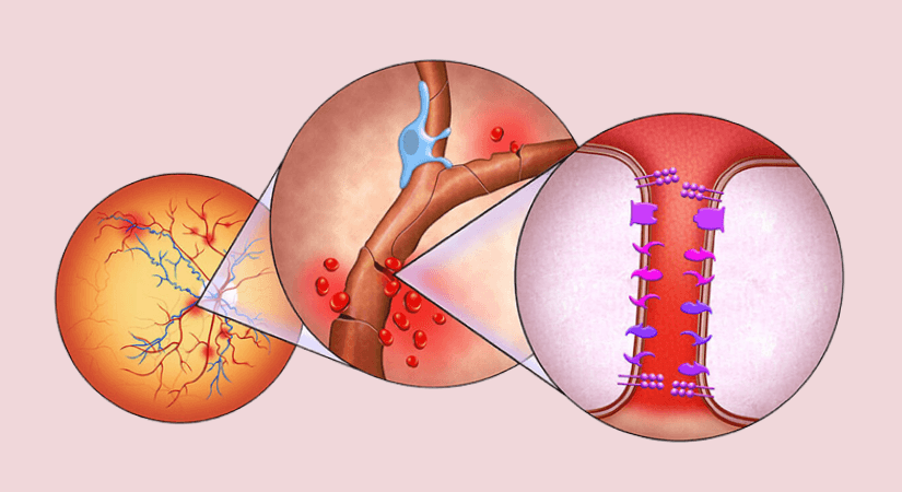 Asimov And RevOpsis Collaborate On RO-104 For Retinal Vascular Diseases