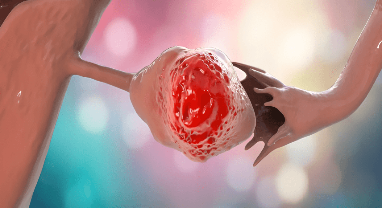 Zentails’ Azenosertib Receives FDA Fast Track Designation For Treating PROC