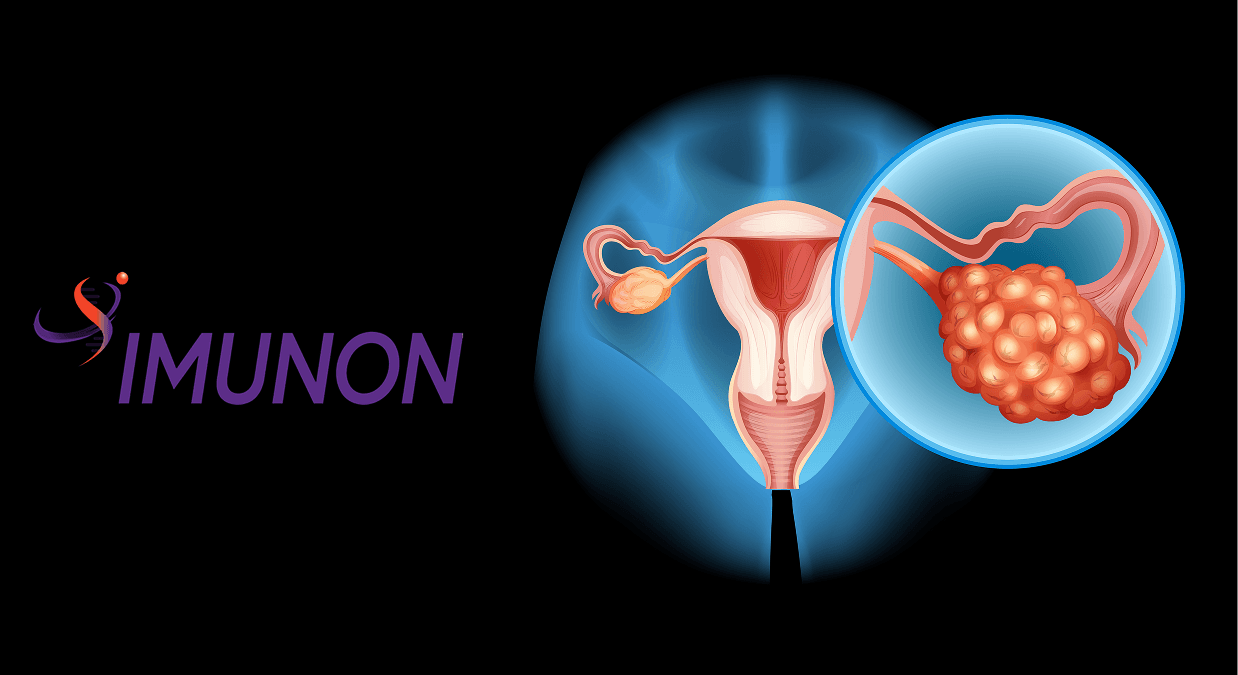 IMUNON Launches First Site For Phase 3 OVATION 3 Trial Of IMNN-001 In Newly Diagnosed Advanced Ovarian Cancer