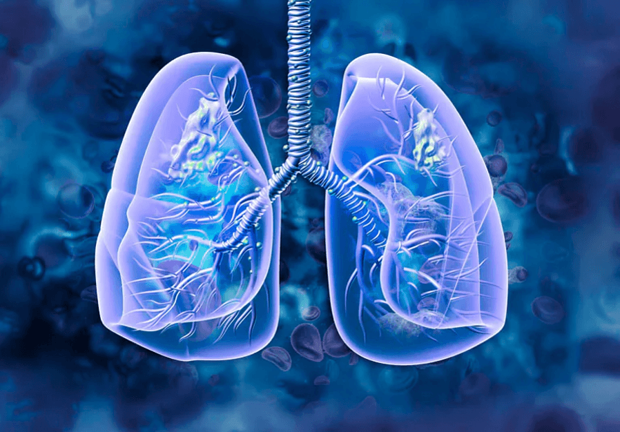 AstraZeneca’s Tagrisso Secures EU Approval For Advanced Lung Cancer Treatment