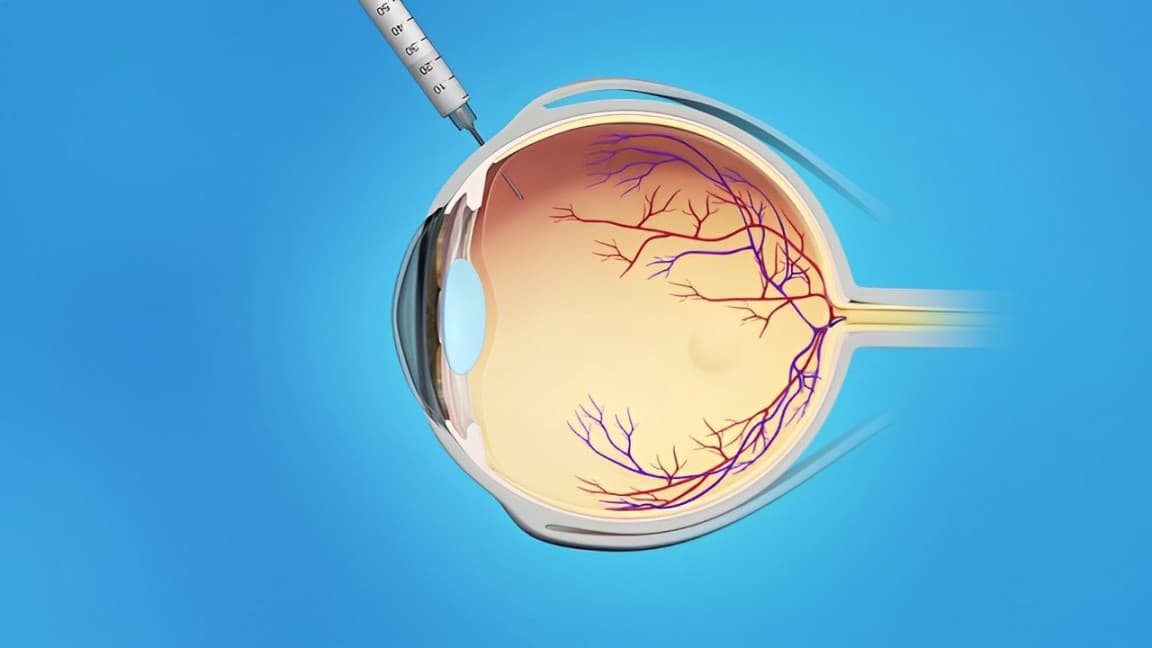 Regeneron’s EYLEA HD® Achieves Key Endpoint In Phase 3 Trial For Retinal Vein Occlusion Treatment