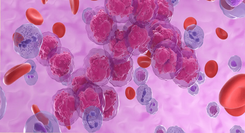 New Therapy Approved for Relapsed Leukemia