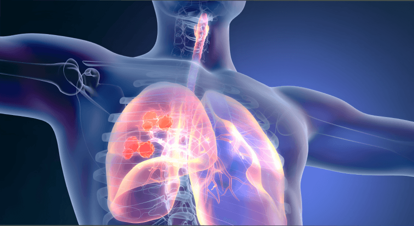 Merck Reports Promising Subcutaneous Pembrolizumab Data