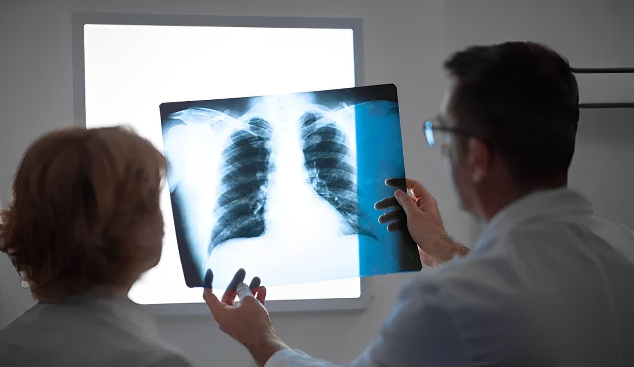 Merck and Moderna Begin Key Phase 3 Trial For Patients With NSCLC