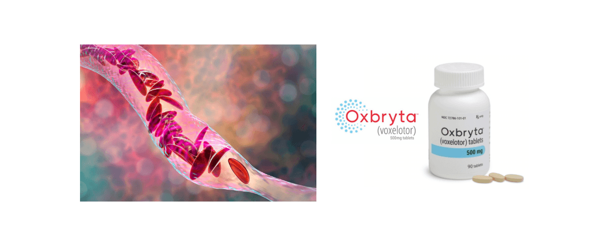 Pfizer Pulls OXBRYTA® Treatment For Sickle Cell Globally