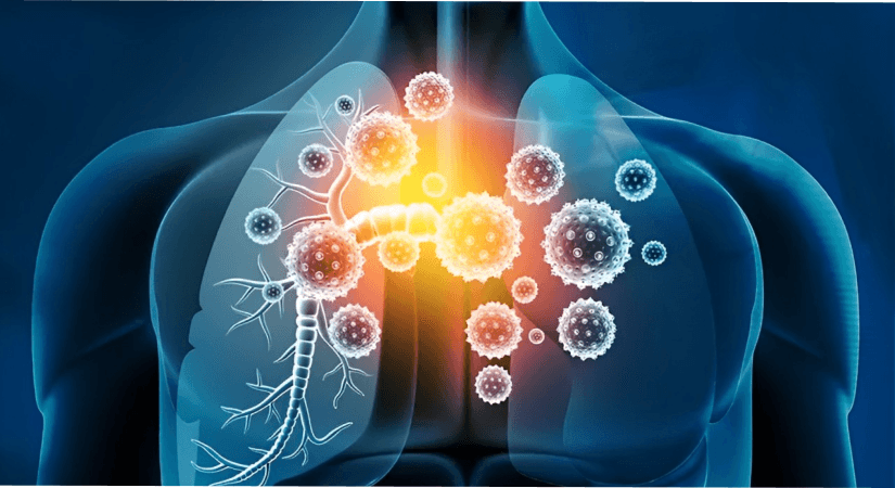 ISLA-101 PROTECT Trial Reaches Key Milestone, Pioneering Hope For Viral Respiratory Infections