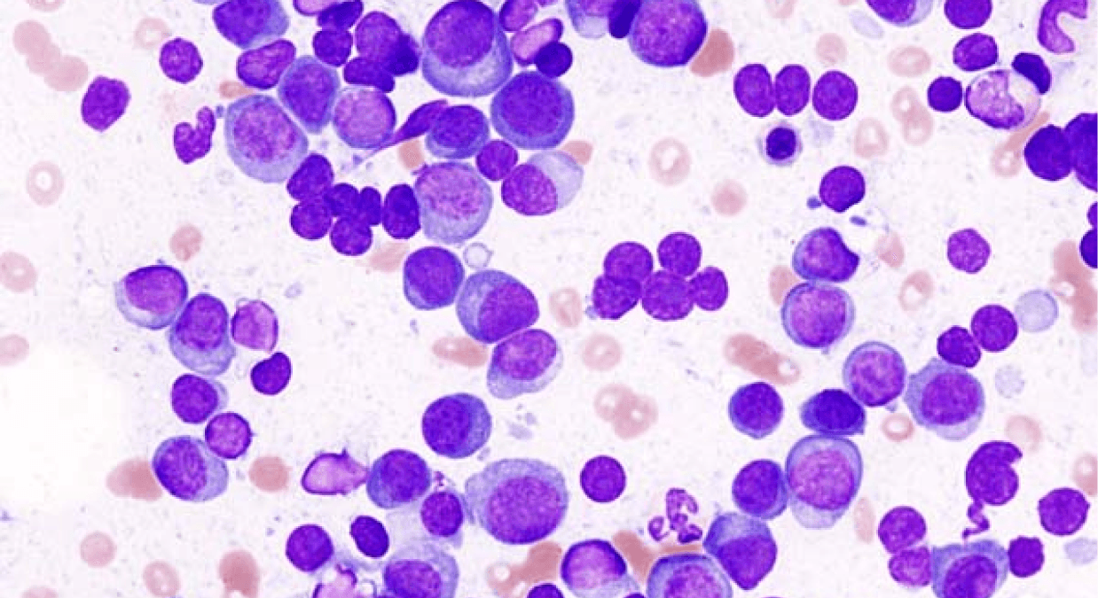 Starton Therapeutics Opens Enrollment For Phase 2a Trial Of STAR-LLD, A Continuous Low-Dose Lenalidomide Therapy For Multiple Myeloma