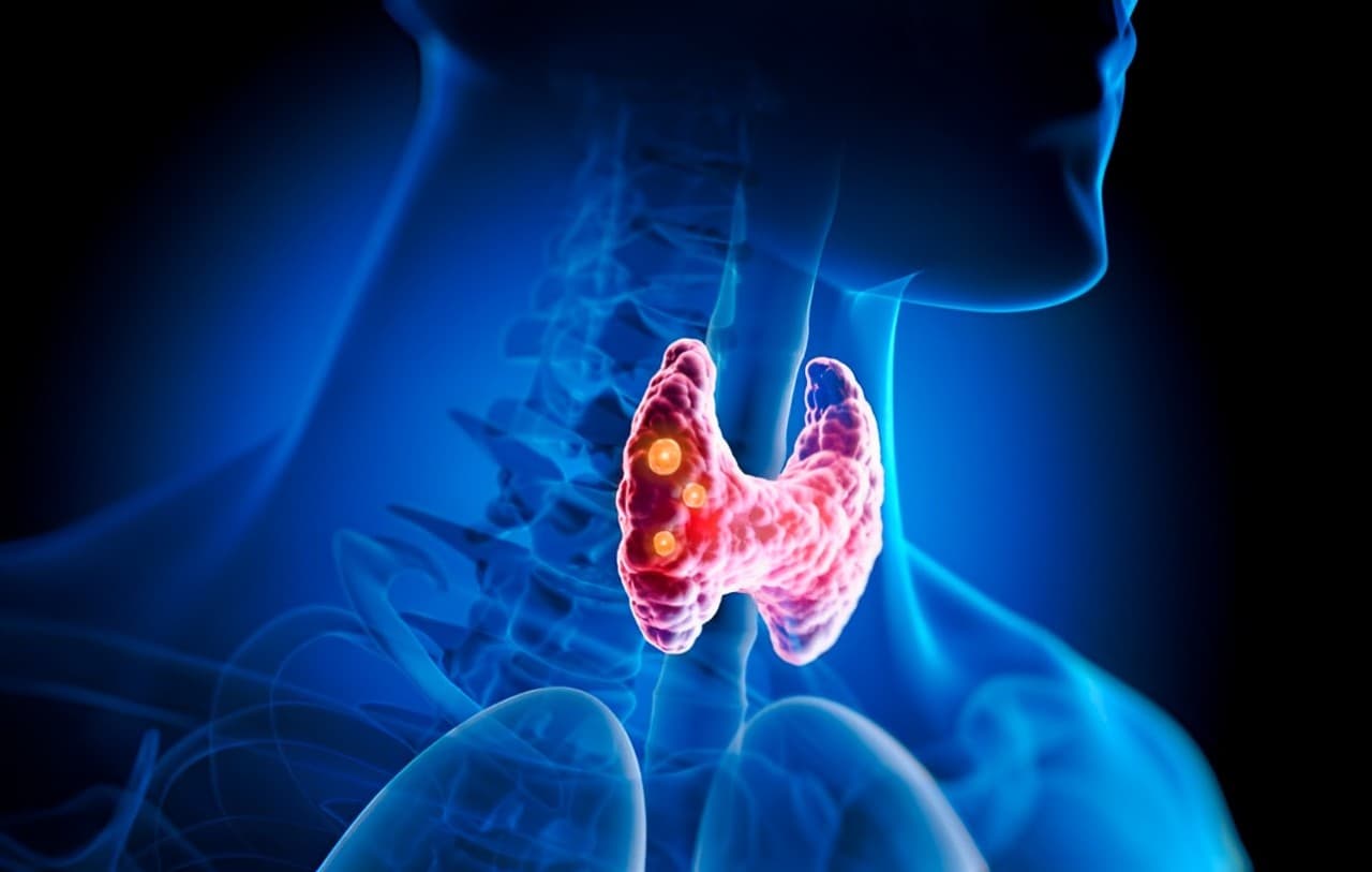Agios Advances Sickle Cell Treatment, Completes Enrolment For Phase 3 RISE UP Study Of Mitapivat